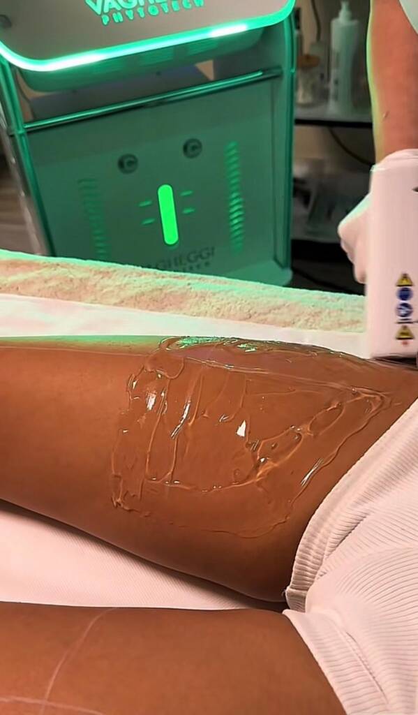 Trattamento Epilazione Laser, Diodo 808, Crystal estetica Padova